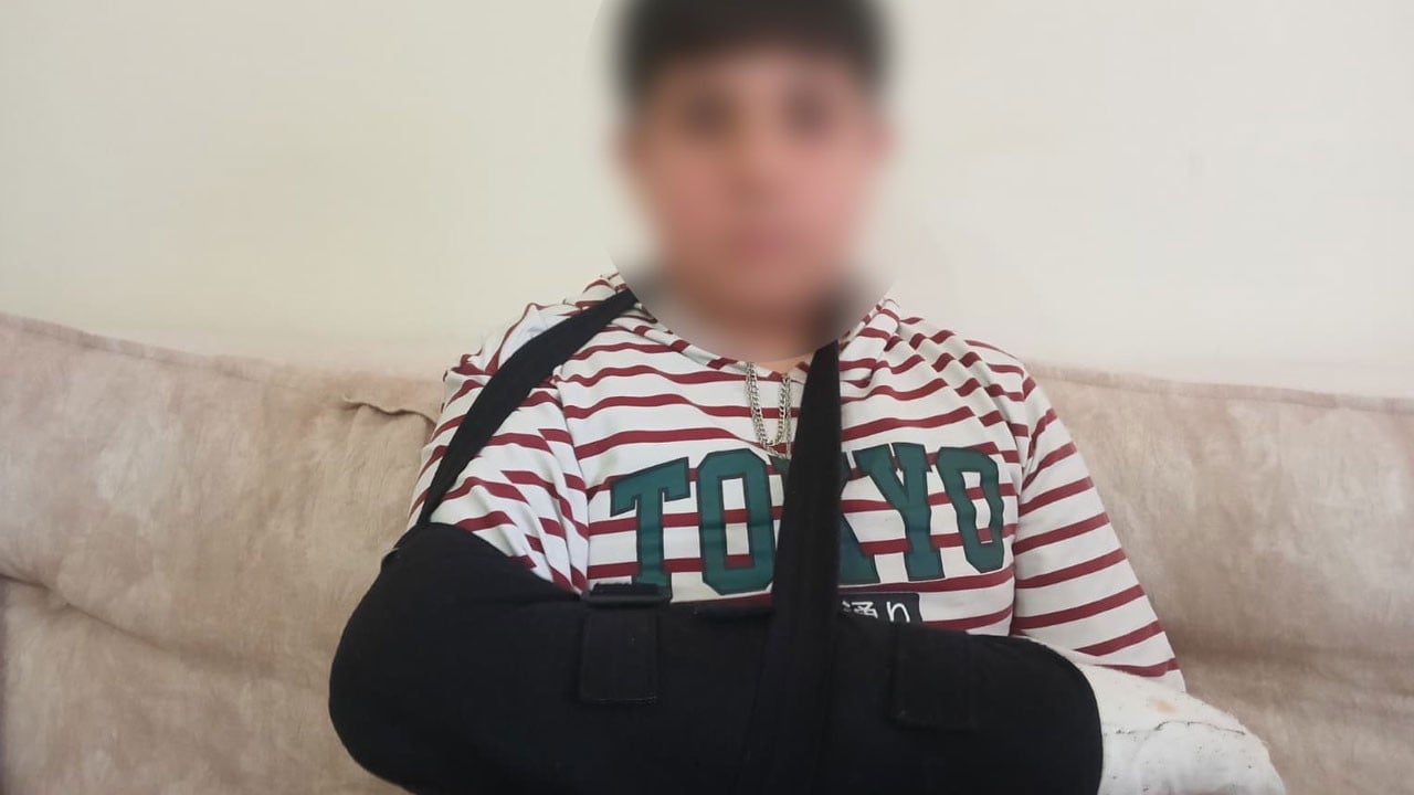 Ne oluyor bu çocuklara! 15 yaşındaki çocuk, 5.sınıf öğrencisinin parmağını kırdı