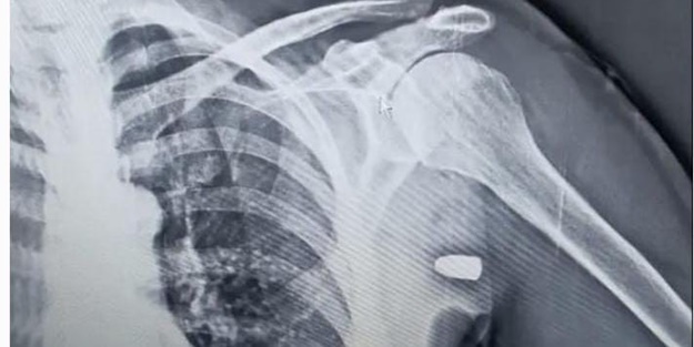 Ne yapsan fayda etmiyor! Trabzon'un baş belası