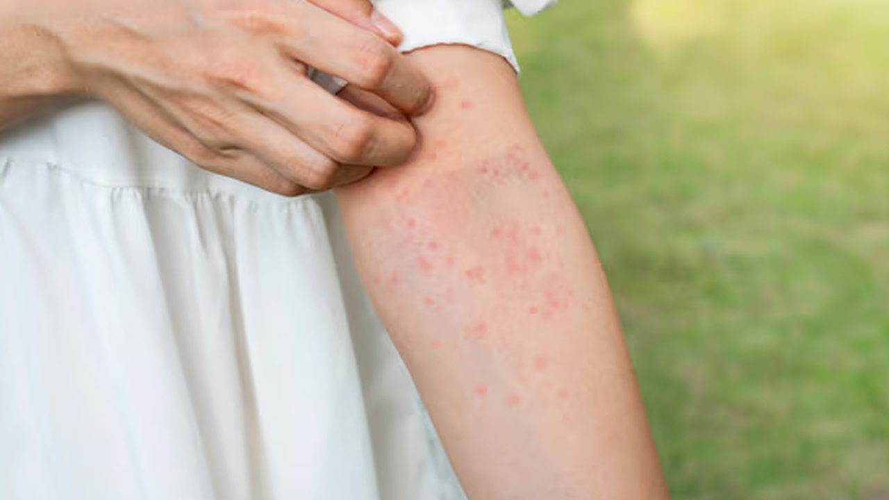 Neden bazı insanlar sivrisinekleri mıknatıs gibi çeker? Kan grubuyla ilgisi yokmuş!