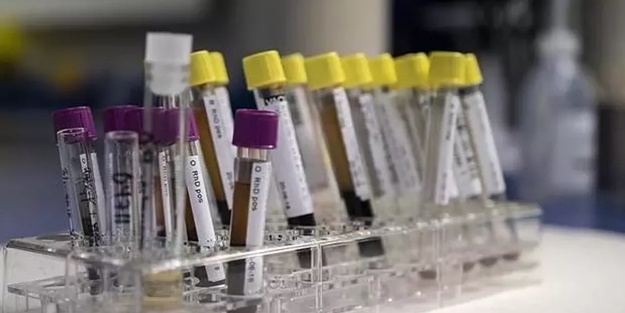 Nedeni belirsiz! DSÖ duyurdu: 74 kişide tespit edildi