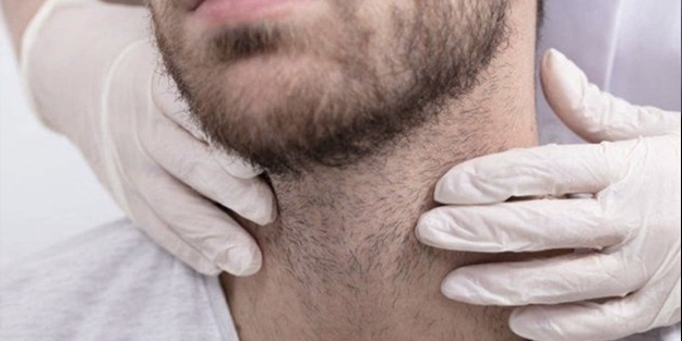 Nefes kokusu gırtlak kanserinin habercisi olabilir!