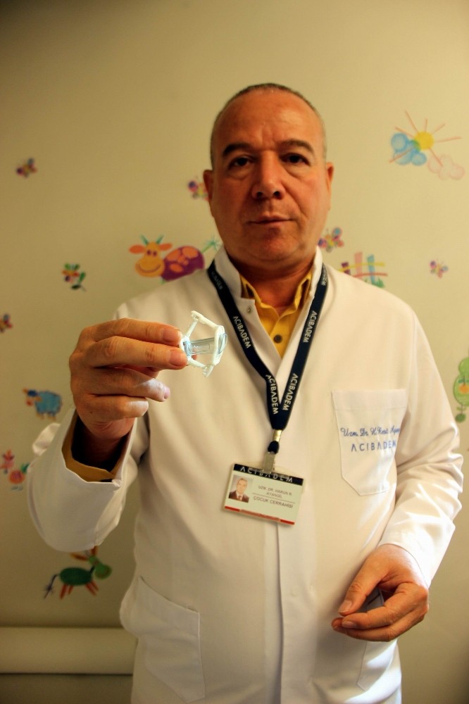 Neo Alisklamp yöntemi ile dikişsiz, kanamasız, estetik sünnet 