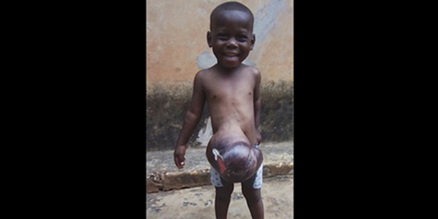 O hastalığa iyileşme umudu