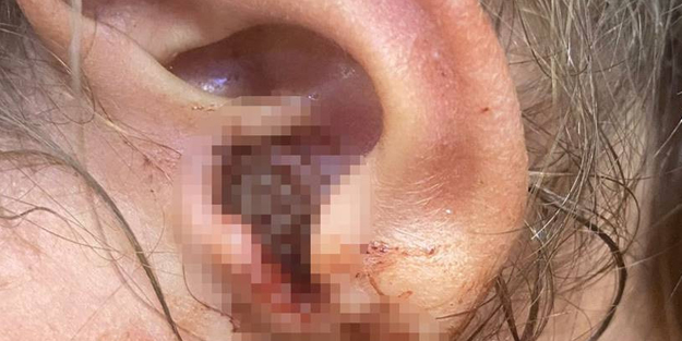 O ilimizde, sadece 3 yaşında heyecan yaşadı: Doktor onun kulağında tam 23 canlı gördü! Hayrete düşürdü