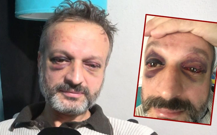 O şarkıcıya öldüresiye dayak! Sebebi, herkesi şok etti