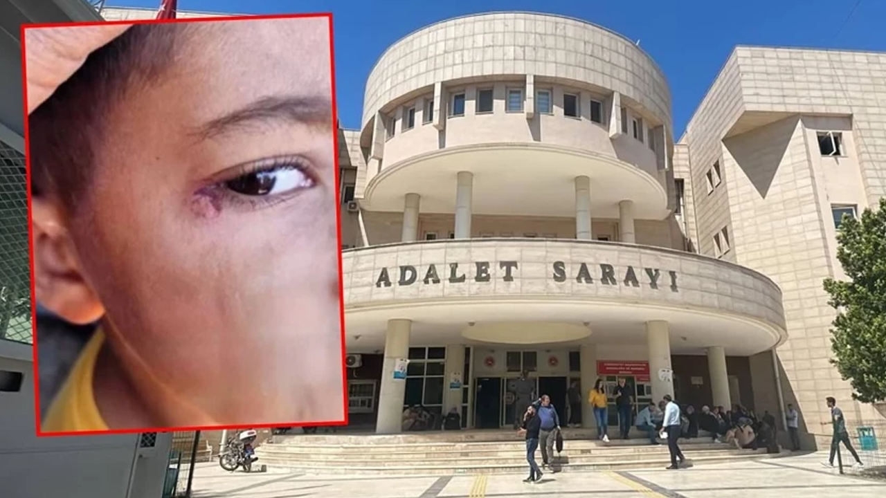 O şehirde kan donduran olay: Öğrencinin yüzünde sigara söndürdü!