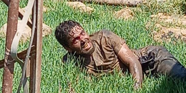 O şehirde kuduz paniği! Hastaneden kaçtı, tarlada yakalandı!