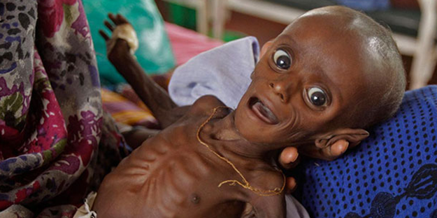 O ülkede 1900 çocuk açlıktan öldü!