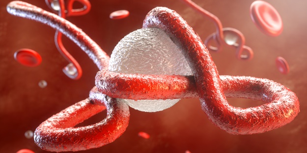 O ülkede 4 gün önce Ebola salgını ilan edilmişti! Harekete geçildi