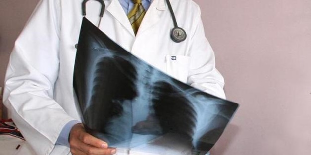 O ülkede kanser hastaları için bir ilk...