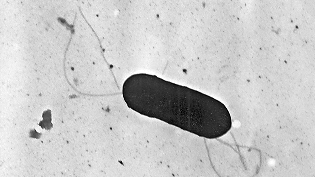 O ülkede listeria şüphesiyle 5 bin ton et toplatılıyor: İfşa edildi!