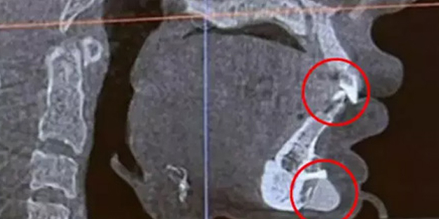 O ünlü havalimanın da ortaya çıktı: Güvenliğinden geçerken fark edildi! Dehşete düşüren görüntüler