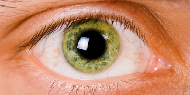 O virüs göz rengini değiştirdi
