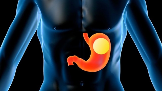 Obeziteye 'haplı' çözüm yolu