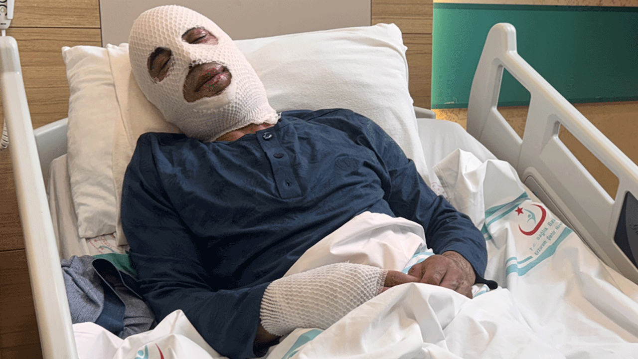 Ocakta ısıttığı sprey boya bomba gibi patladı: Pencereler kapılar kırıldı, yanmadık yeri kalmadı!