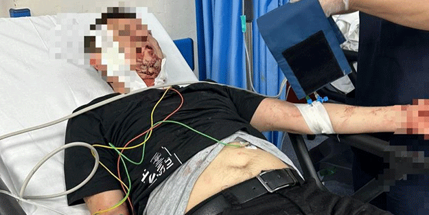 Oğlu için kendini feda etti... Bursa'da başıboş köpek dehşeti