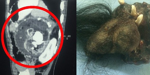 'Oğlumun karnında şeytan var' dedi, bakın ne çıktı!