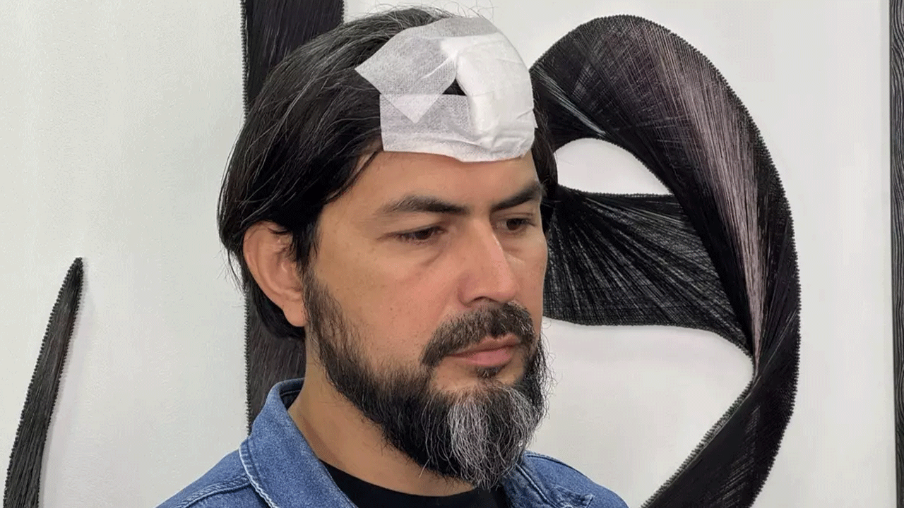 Öğretmeni yaralayan veli gözaltında