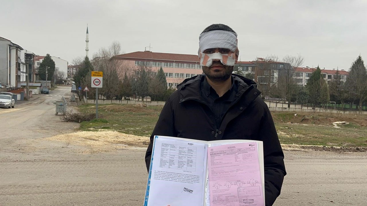 Öğretmenler bile bunu yapıyorsa! Meslektaşının yüzüne sıcak çay fırlattı