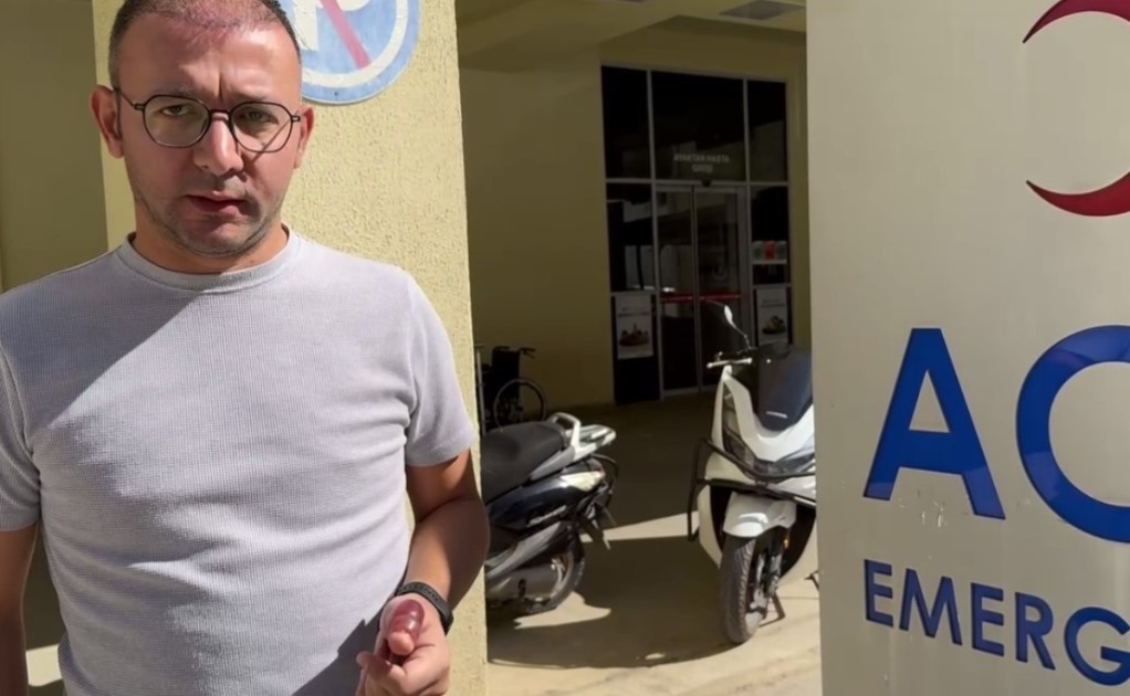 Öldü sandığı balık hastanelik etti! Parmağı uzadı!