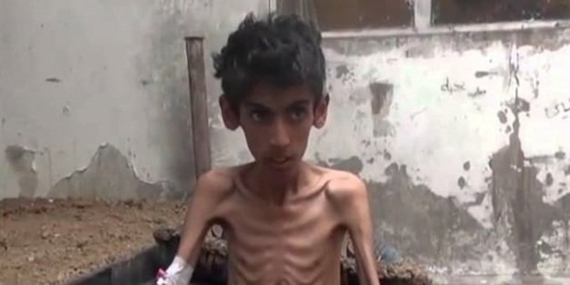 'Ölmemek için artık kedileri yiyoruz'