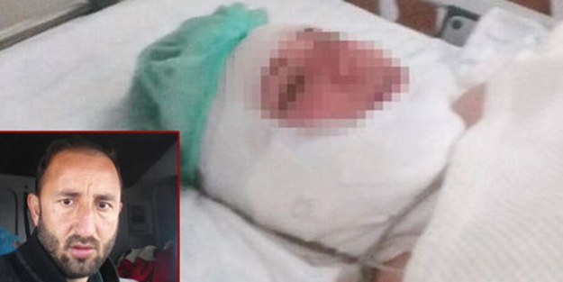 Ölü taklidi yaparak canını kurtardı