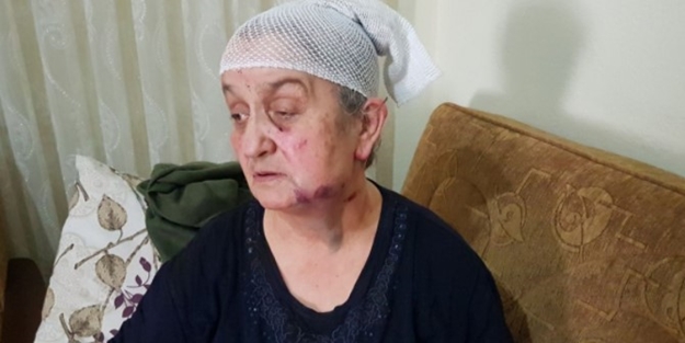 Ölü taklidi yaparak kurtuldu... Saldırgan ortaya çıktı