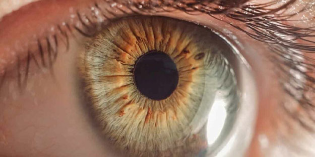 Ölümcül hastalık gözlerden ortaya çıkıyor