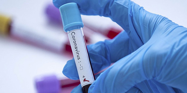 Ölümcül virüse karşı zafer kazandı derken… Gizli belgeler ortaya çıktı