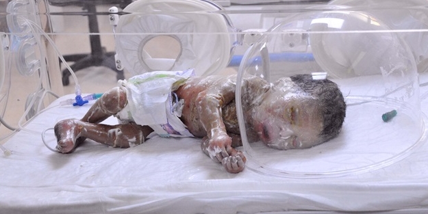 Vücudu sürekli çatlıyor