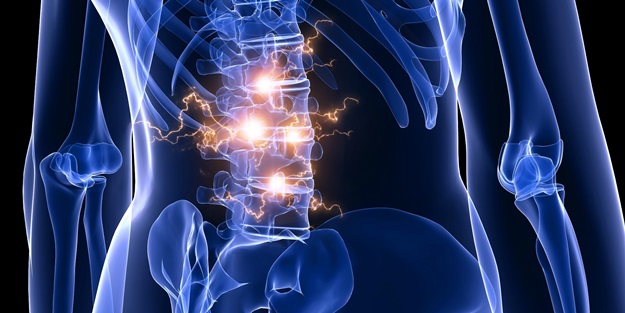 Omurga hastalığı Spinal Stenoz boğaz enfeksiyonları kadar sık görülüyor!