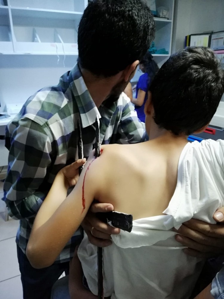 Omuzuna saplanan korkuluk demiri ile hastaneye kaldırıldı 