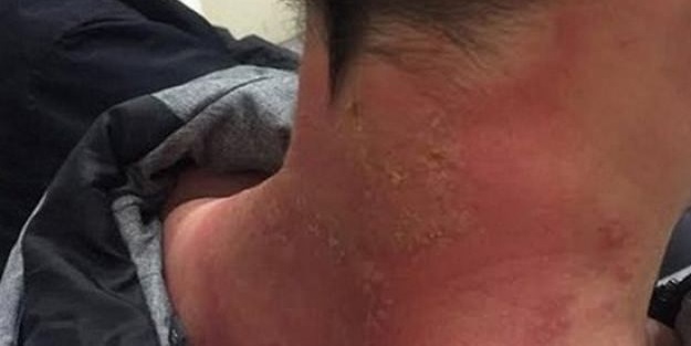 Ona dokununca bu hale geldiler