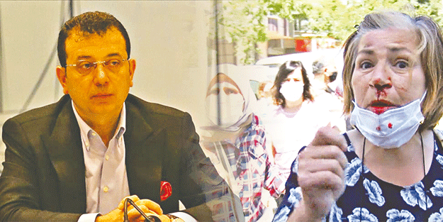 Önce kadınları darbetti şimdi ağaçları katletti