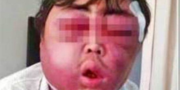 Onu bu hale bakın ne getirdi!