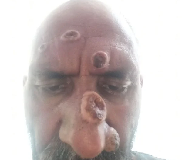 Onu bu hale getiren şeye şok olacaksınız! Hayatı karardı, aylar sonra sebebi belli oldu