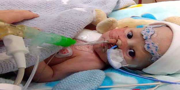 Organ bekleyenler listesinin en küçük hastasıydı