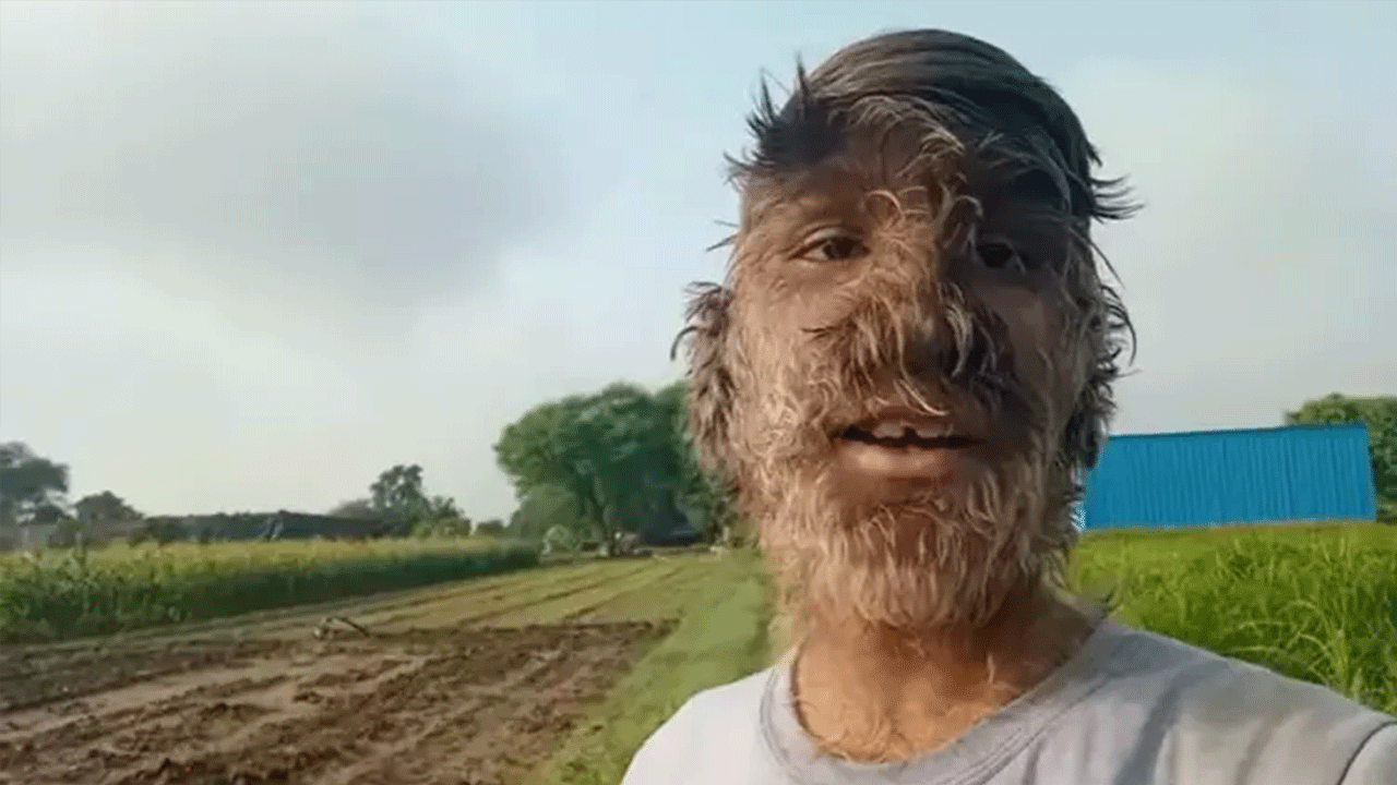 Orta Çağ hastalığı tekrar hortladı! Sadece İspanya'da çok sayıda bebekte görüldü