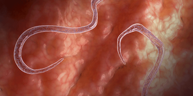 Osmanlı hekimleri önerdi! Kurtları döküyor