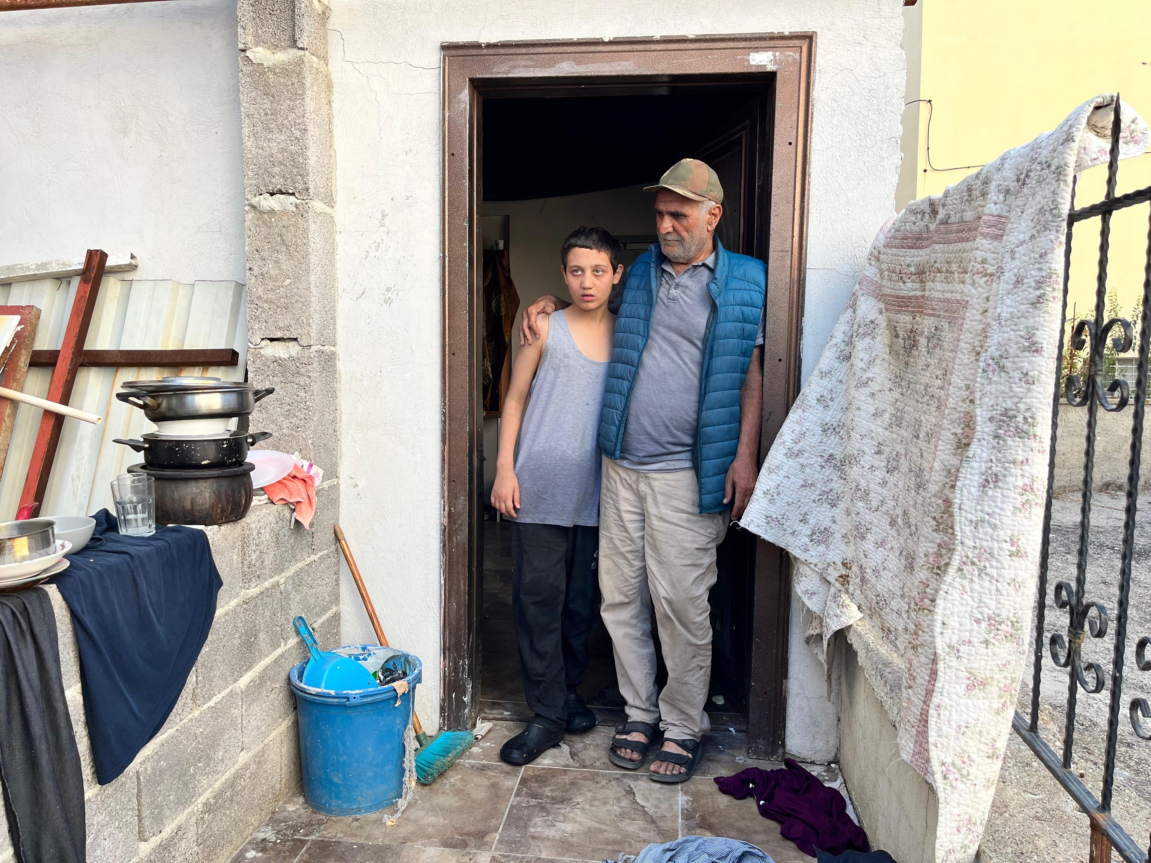 Otizmli torun evi yaktı