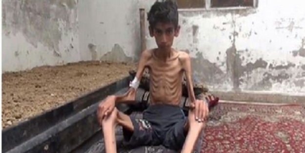 Oxfam: 'G7 ülkeleri Milyonlarca kişiyi açlıktan ölüme terk etti'