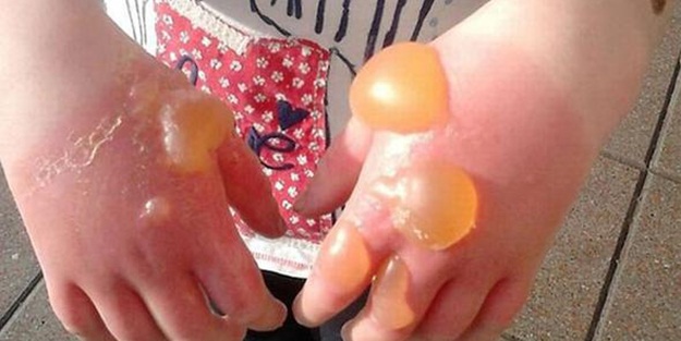 Oyun oynarken yanlışlıkla dokundu, bu hale geldi!