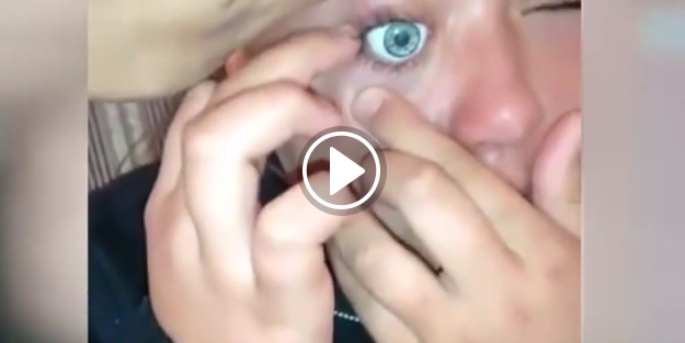 Oyuncak bebeğin gözünü kendi gözüne taktı!