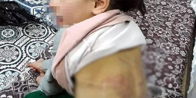 Öz kızına işkence yapıp dilendirdi!