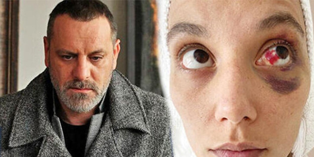 Ozan Güven'in darp davasına bakanlık el attı