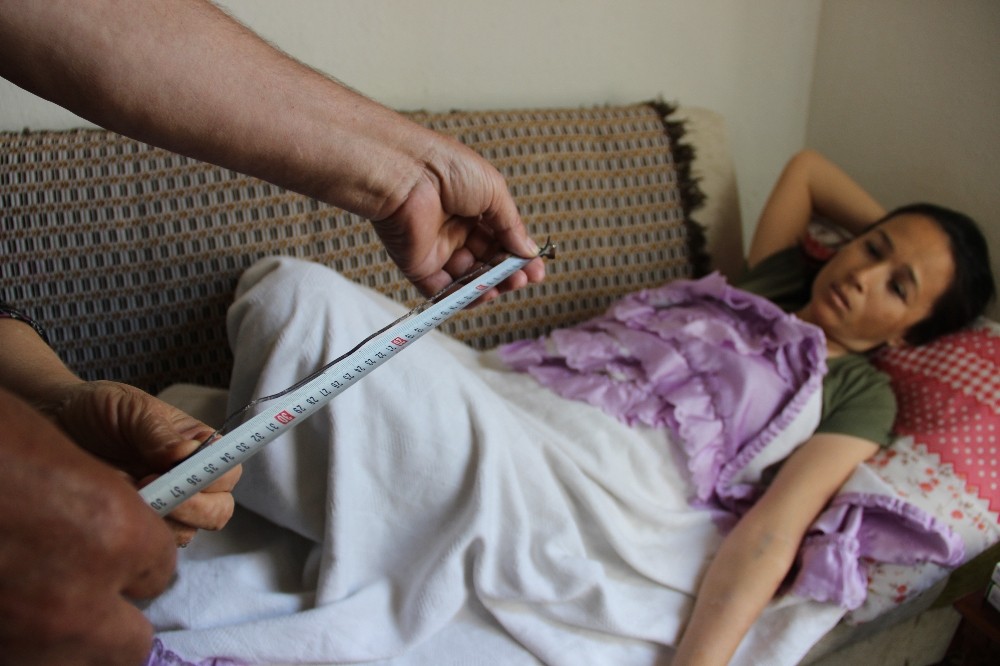 (Özel) Böbreğinde unutulan katater teli 10 yıl sonra fark edildi 