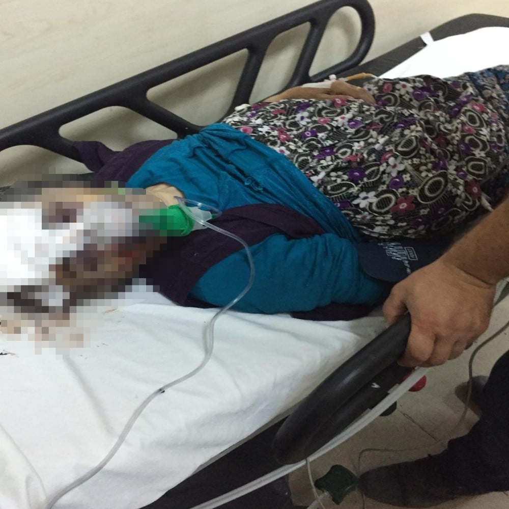 (Özel) Esenyurt’ta otomobilin çarptığı yaşlı kadın hastanede yaşam mücadelesi veriyor 