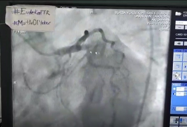 (ÖZEL) İşte aramızdaki fark 