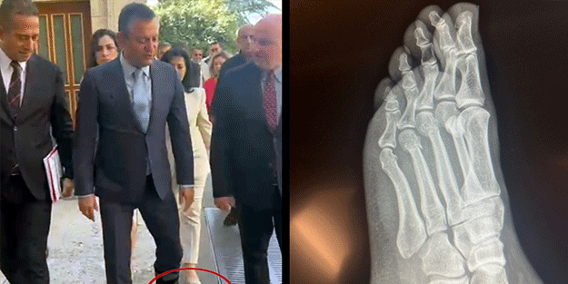 Özgür Özel kırık ayakla mı mışıl mışıl uyudu? "Manisa’da" düşüyor "Ankara’da" hastaneye gidiyor