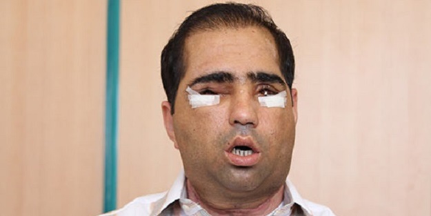 Salih Üslün'ün ölüm nedenini Prof. Dr. Ömer Özkan açıkladı